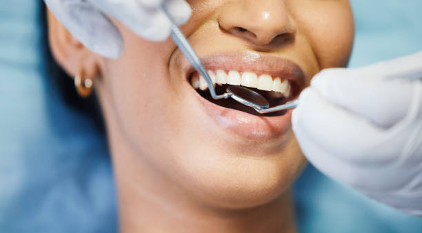 Best Emergency Dental Extractions in Willow Creek, CA